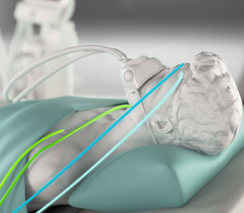 Zoom-in auf Kopf und Oberkörper eines Patienten mit EKG- und EEG-Kabeln und Atemmaske